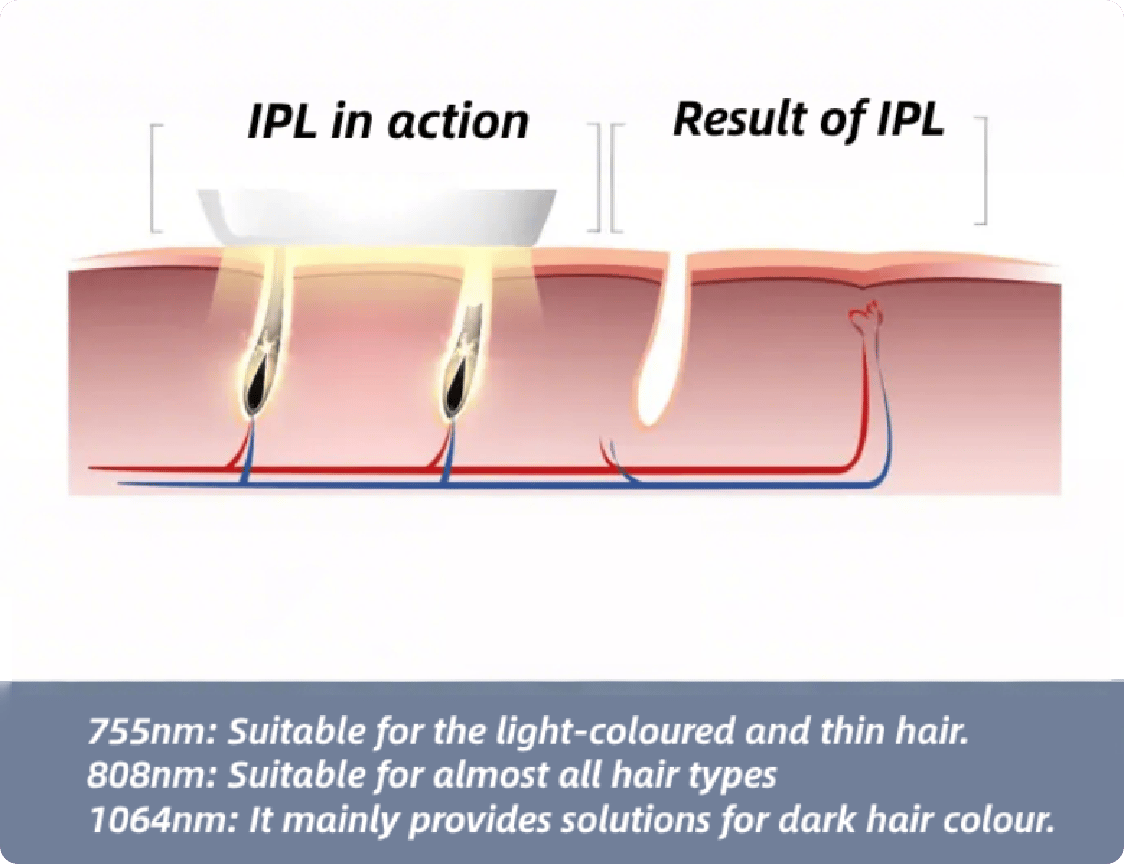 how ipl works (1)